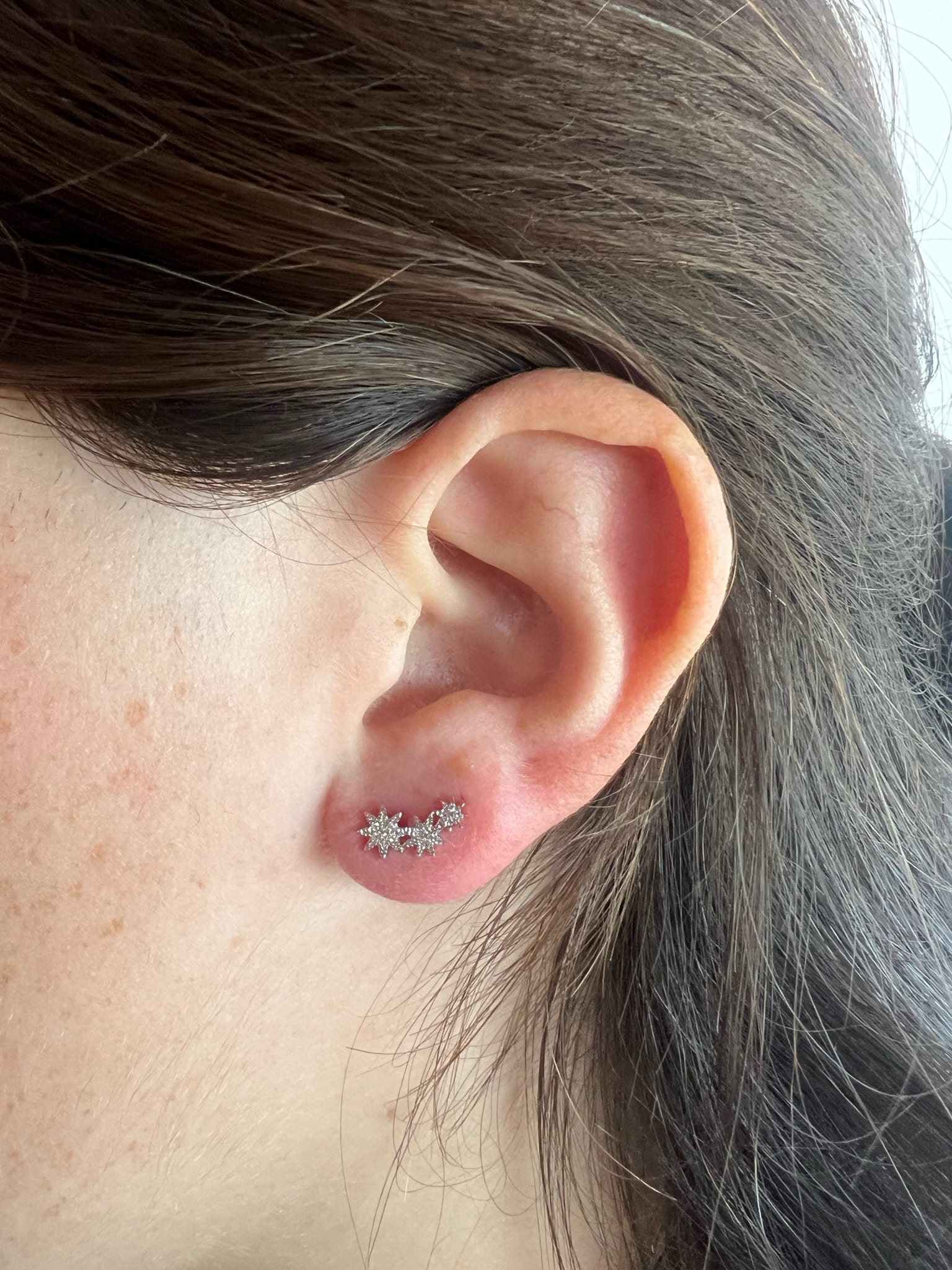 Aros-Trepadoras-Triple-Sun-White